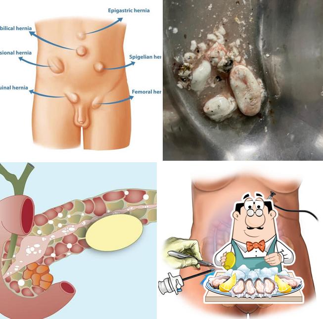 Oysters at Dr. John's Liver, Gastro & Laparoscopy Clinic(endoscopy, gastroenterologist, laparoscopic surgery, colonoscopy, liver )